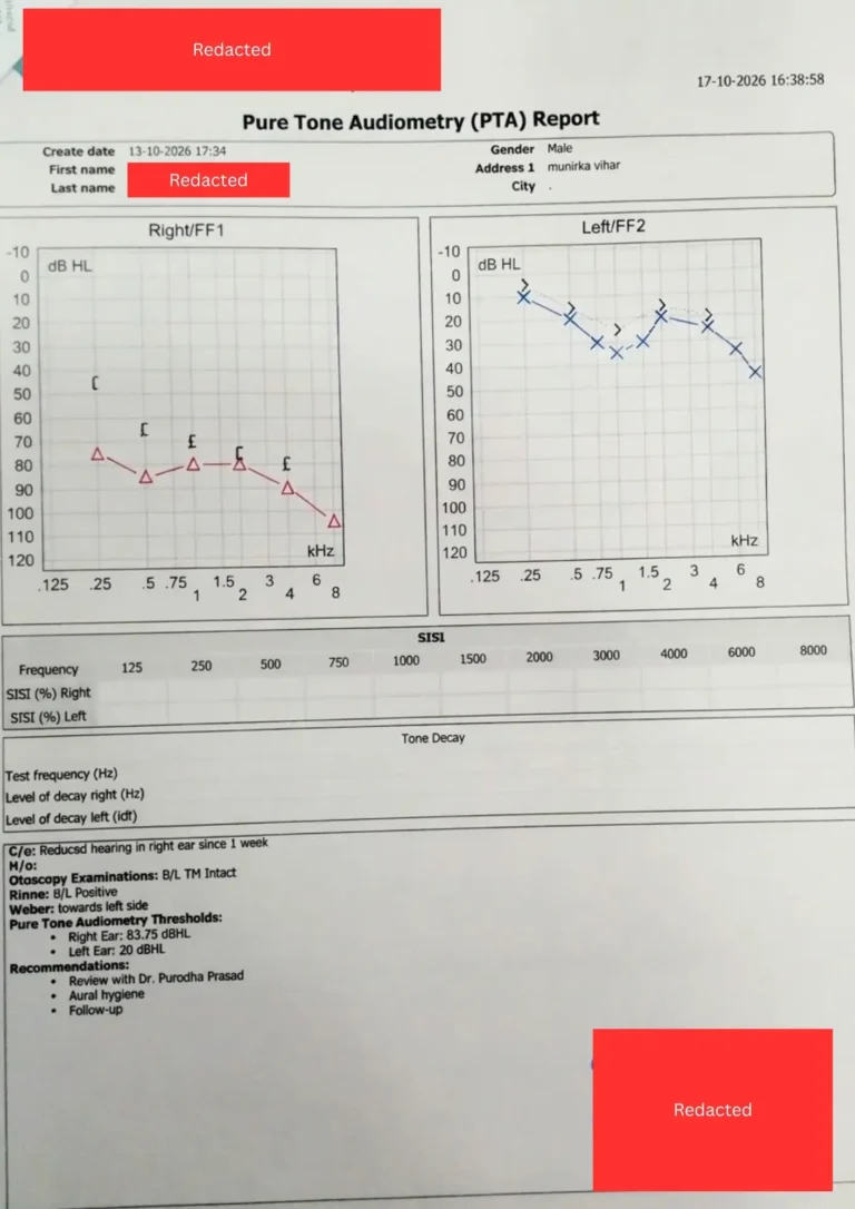 Audiometry report before Hearing loss treatment in Delhi by Dr. Purodha Prasad.