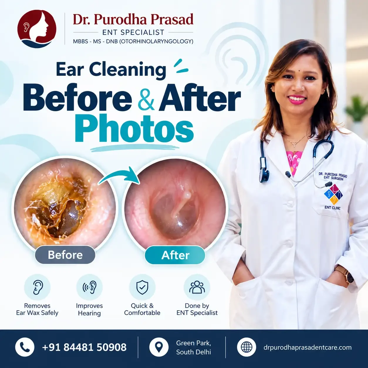 Infographic about Ear Cleaning Before After Photos in Delhi.