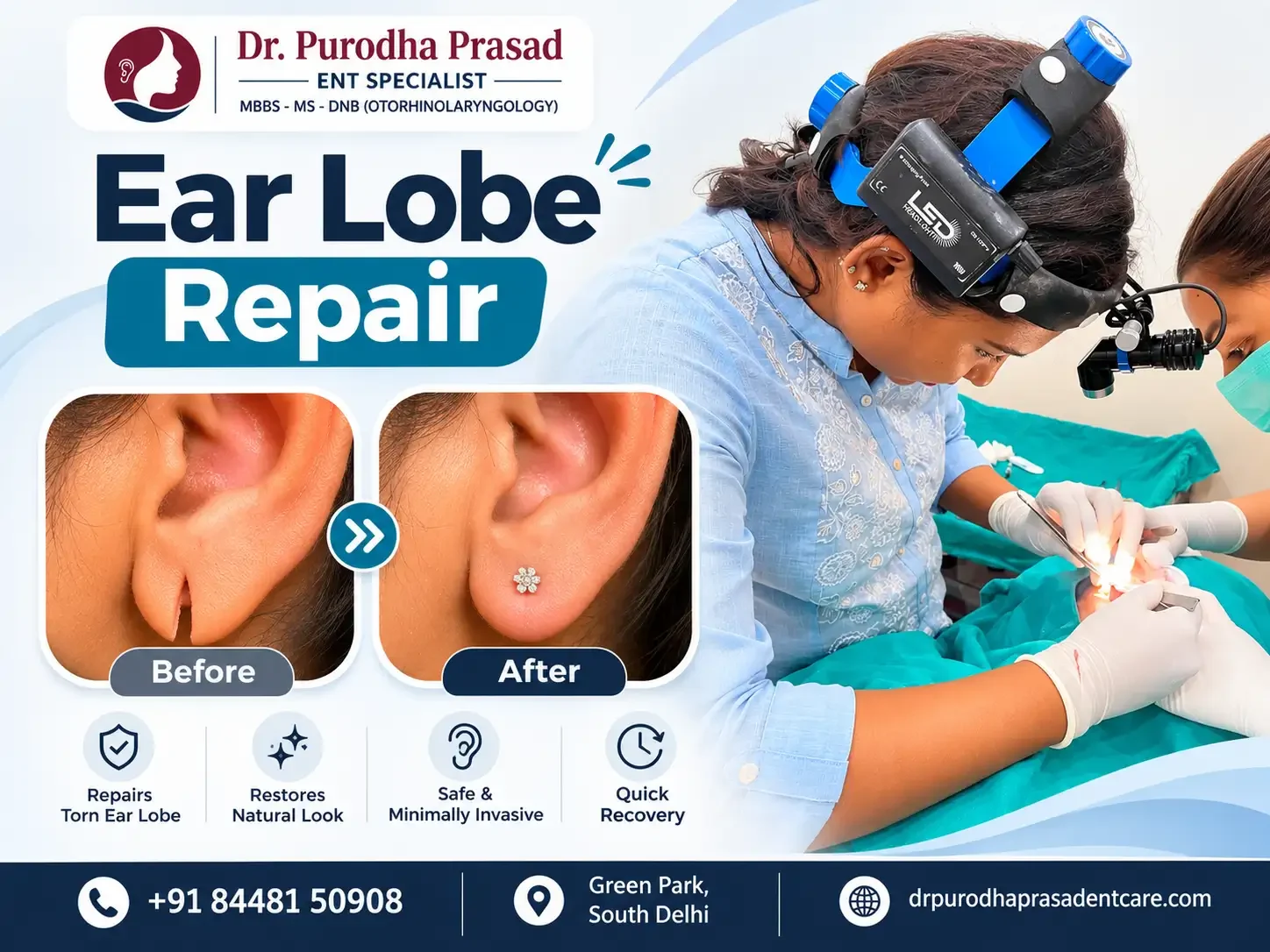 Infographic about Ear lobe repair before after photos in Delhi.